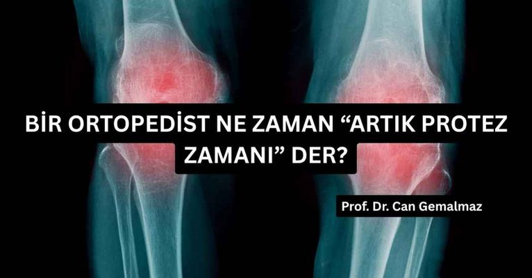 Bir Ortopedist Ne Zaman “Artık Protez Zamanı” Der?